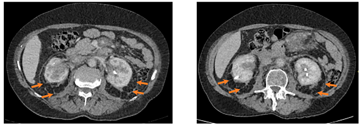 Аксиальная проекция