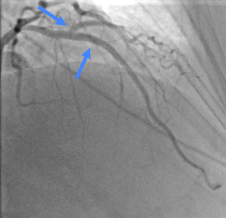  Вид кровотока